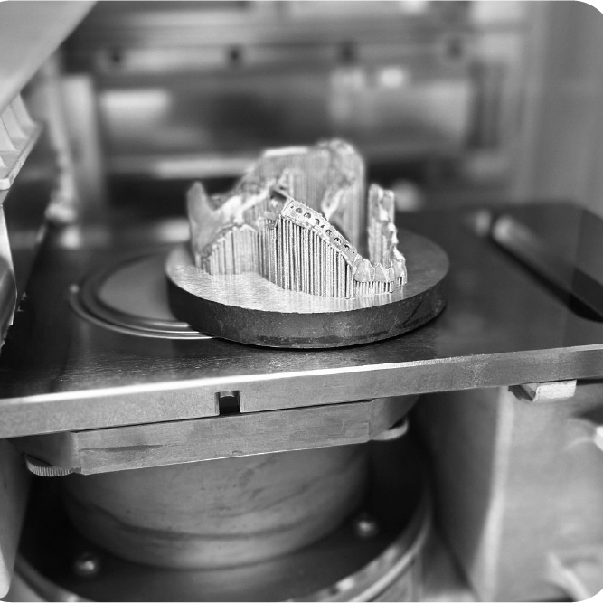 Avtagbar protetik – metallskelett med precision och komfort